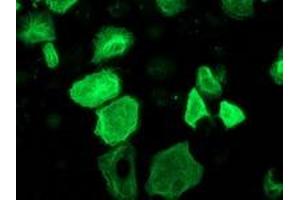 Anti-RASSF1 mouse monoclonal antibody (ABIN2454254) immunofluorescent staining of COS7 cells transiently transfected by pCMV6-ENTRY RASSF1 (RC213525). (RASSF1 抗体)