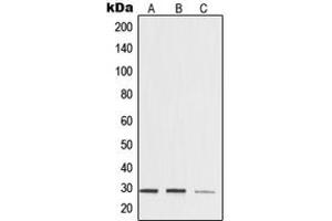 Western blot analysis of 14-3-3 zeta expression in HeLa (A), mouse brain (B), rat kidney (C) whole cell lysates. (14-3-3 zeta 抗体  (Center))