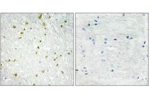 Immunohistochemistry analysis of paraffin-embedded human brain tissue, using SNAPC5 Antibody. (SNAPC5 抗体  (AA 10-59))