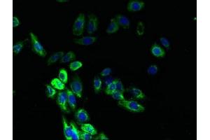 Immunofluorescent analysis of HepG2 cells using ABIN7145066 at dilution of 1:100 and Alexa Fluor 488-congugated AffiniPure Goat Anti-Rabbit IgG(H+L) (DARC 抗体  (AA 1-63))