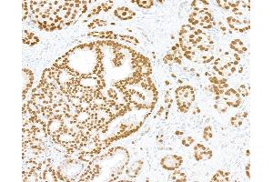 Immunohistochemistry (IHC) image for anti-Androgen Receptor (AR) (AA 1-50) antibody (ABIN7795784)
