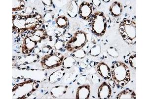 Immunohistochemical staining of paraffin-embedded Kidney tissue using anti-FAHD2Amouse monoclonal antibody. (FAHD2A 抗体)