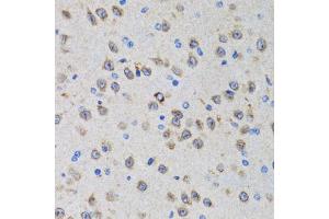 Immunohistochemistry of paraffin-embedded rat brain using PGRMC1 antibody (ABIN1876820) at dilution of 1:100 (40x lens). (PGRMC1 抗体)