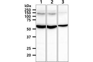 The cell lysates (40ug) were resolved by SDS-PAGE, transferred to PVDF membrane and probed with anti-human TXNRD1 antibody (1:1000). (TXNRD1 抗体)