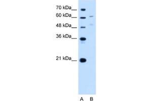 Western Blotting (WB) image for anti-UDP Glucuronosyltransferase 1 Family, Polypeptide A4 (UGT1A4) antibody (ABIN2463019) (UGT1A4 抗体)