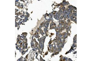 IHC analysis of ME2 using anti-ME2 antibody (ABIN7600967).