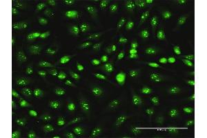 Immunofluorescence of monoclonal antibody to SKP1 on HeLa cell. (SKP1 抗体  (AA 53-160))