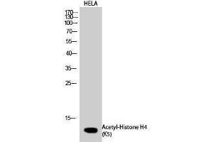 Western Blotting (WB) image for anti-Histone H4 (acLys5) antibody (ABIN6285507) (Histone H4 抗体  (acLys5))