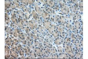 Immunohistochemical staining of paraffin-embedded Human Kidney tissue using anti-TACC3 mouse monoclonal antibody. (TACC3 抗体)