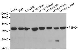 Western blot analysis of extracts of various cell lines, using PSMC6 antibody. (PSMC6 抗体  (AA 20-150))
