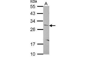 WB Image Sample (30 ug of whole cell lysate) A: SK-N-SH 12% SDS PAGE antibody diluted at 1:500 (CNOT8 抗体)
