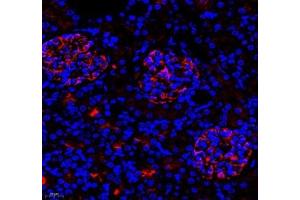Immunofluorescence (Paraffin-embedded Sections) (IF (p)) image for anti-Chemokine (C-C Motif) Ligand 12 (Ccl12) antibody (ABIN7073445)
