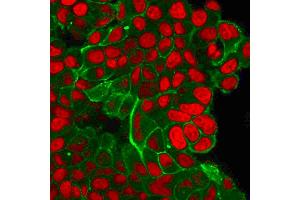 Flow Cytometric Analysis of trypsinized PFA-fixed MCF-7 cells. (ErbB2/Her2 抗体  (AA 311-462))