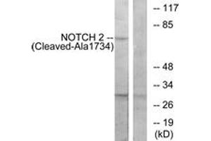 Western blot analysis of extracts from Jurkat cells, treated with etoposide 25uM 24h, using NOTCH2 (Cleaved-Ala1734) Antibody. (NOTCH2 抗体  (Cleaved-Ala1734))