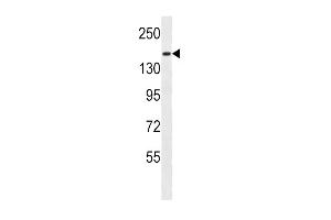 PCDH9 Antibody (C-term) (ABIN657109 and ABIN2837896) western blot analysis in MDA-M cell line lysates (35 μg/lane). (Protocadherin 9 抗体  (C-Term))