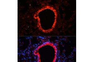 Immunofluorescence (IF) image for anti-NLR Family, CARD Domain Containing 4 (NLRC4) antibody (ABIN7008065)