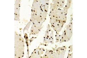 Immunohistochemistry (IHC) image for anti-Karyopherin (Importin) alpha 4 (KPNA4) (AA 1-240) antibody (ABIN3015855)