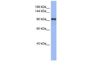 WB Suggested Anti-LAntibody Titration:  0. (LARP1 抗体  (N-Term))