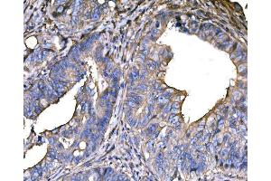 IHC analysis of SNAP23 using anti-SNAP23 antibody (ABIN7603236).
