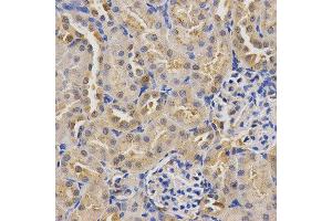 Immunohistochemistry (IHC) image for anti-Syndecan Binding Protein (Syntenin) (SDCBP) antibody (ABIN1876548) (SDCBP 抗体)