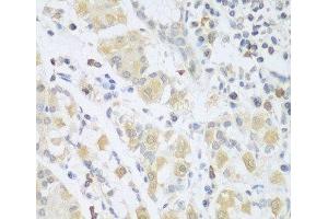 Immunohistochemistry of paraffin-embedded Human stomach using SGCB Polyclonal Antibody at dilution of 1:100 (40x lens). (SGCB 抗体)