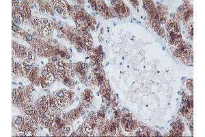 Immunohistochemical staining of paraffin-embedded Human liver tissue using anti-FBXO21 mouse monoclonal antibody.