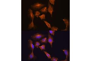 Immunofluorescence analysis of C6 cells using HOOK3 antibody (ABIN7267781) at dilution of 1:100. (HOOK3 抗体  (AA 489-718))