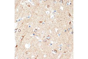 Immunohistochemistry of paraffin-embedded human brain using DCR2 Rabbit mAb (ABIN7271063) at dilution of 1:100 (40x lens). (DcR2 抗体)