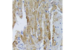 Immunohistochemistry of paraffin-embedded mouse heart using ACADL antibody (ABIN1678519, ABIN3015429, ABIN3015430 and ABIN6216381) at dilution of 1:100 (40x lens). (ACADL 抗体  (AA 31-210))