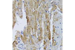 Immunohistochemistry of paraffin-embedded mouse heart using ACADL antibody (ABIN1678519, ABIN3015429, ABIN3015430 and ABIN6216381) at dilution of 1:100 (40x lens). (ACADL 抗体  (AA 31-210))