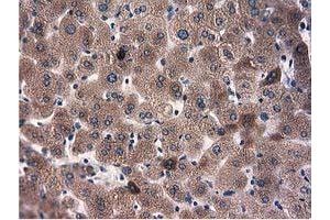 Immunohistochemical staining of paraffin-embedded Human thyroid tissue using anti-L1CAM mouse monoclonal antibody. (L1CAM 抗体)