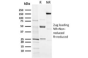 SDS-PAGE Analysis Purified Aurora B Rabbit Recombinant Monoclonal (AURKB/3121R). (Recombinant Aurora Kinase B 抗体  (AA 89-251))