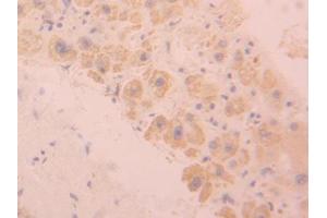DAB staining on IHC-P; Samples: Human Liver Tissue (SIGLEC9 抗体  (AA 23-142))