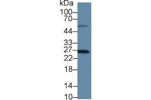 Western Blot; Sample: Human HT1080 cell lysate; Primary Ab: 3µg/ml Rabbit Anti-Human MSRA Antibody Second Ab: 0. (MSRA 抗体  (AA 27-235))