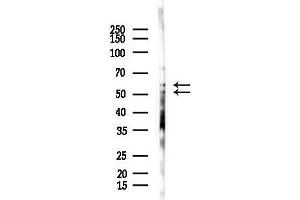 Western blot analysis of lysates from  cells(starvation,24h treatment), using SHC Antibody at 1/1000 dilution.