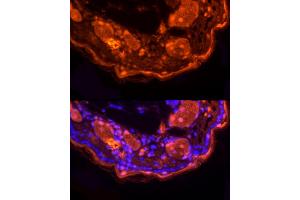 Immunofluorescence analysis of mouse skin using LORICRIN Rabbit pAb (ABIN7268295) at dilution of 1:200 (40x lens). (LOR 抗体)