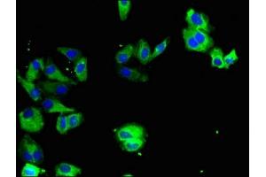 Immunofluorescent analysis of HepG2 cells using ABIN7174052 at dilution of 1:100 and Alexa Fluor 488-congugated AffiniPure Goat Anti-Rabbit IgG(H+L) (TYRO3 抗体  (AA 728-873))