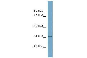 FGL1 antibody used at 1 ug/ml to detect target protein.