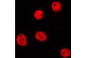 ABIN6275684 staining Hela by IF/ICC. (ZBTB40 抗体  (Internal Region))