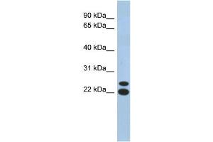 WB Suggested Anti-C19orf54 Antibody Titration: 0. (C19orf54 抗体  (N-Term))