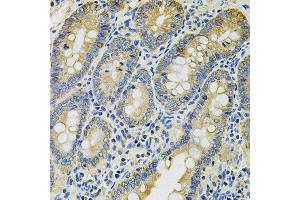 Immunohistochemistry of paraffin-embedded rat intestine using KRT20 Antibody. (KRT20 抗体  (AA 245-424))