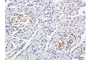 Immunohistochemistry (IHC) image for anti-Protein Phosphatase 1, Catalytic Subunit, beta Isoform (PPP1CB) (AA 155-250) antibody (ABIN725465)