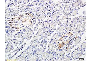 Formalin-fixed and paraffin embedded: rat pancreas tissue labeled with Anti-PP-1B Polyclonal Antibody (ABIN725465), Unconjugated at 1:300 followed by conjugation to the secondary antibody and DAB staining (PPP1CB 抗体  (AA 155-250))