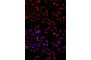 Immunofluorescence analysis of A549 cells using SLC22A11 antibody. (SLC22A11 抗体  (AA 40-150))