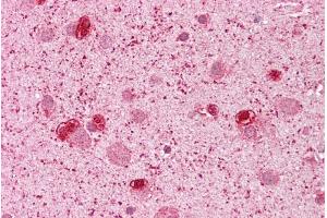 Human brain; Immunohistochemistry with Brain, cortex tissue at an antibody concentration of 5ug/ml using anti-GSH2 antibody ; GSH2 antibody - N-terminal region in Human brain cells using Immunohistochemistry (GSX2 抗体  (N-Term))