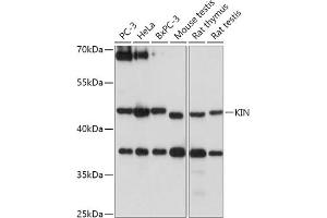 Western blot analysis of extracts of various cell lines, using KIN antibody (ABIN7268118) at 1:1000 dilution. (KIN 抗体  (AA 180-270))