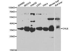 Western blot analysis of extracts of various cell lines, using GALE antibody (ABIN5973962) at 1/1000 dilution. (GALE 抗体)