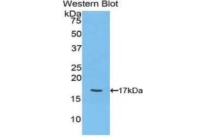 Western Blotting (WB) image for anti-Ly1 Antibody Reactive (LYAR) (AA 271-386) antibody (ABIN1859730) (LYAR 抗体  (AA 271-386))
