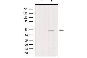 Western blot analysis of extracts from Hela, using VIPR2 Antibody. (VIPR2 抗体  (Internal Region))