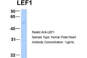 Host:  Rabbit  Target Name:  LEF1  Sample Type:  Human Fetal Heart  Antibody Dilution:  1. (LEF1 抗体  (Middle Region))